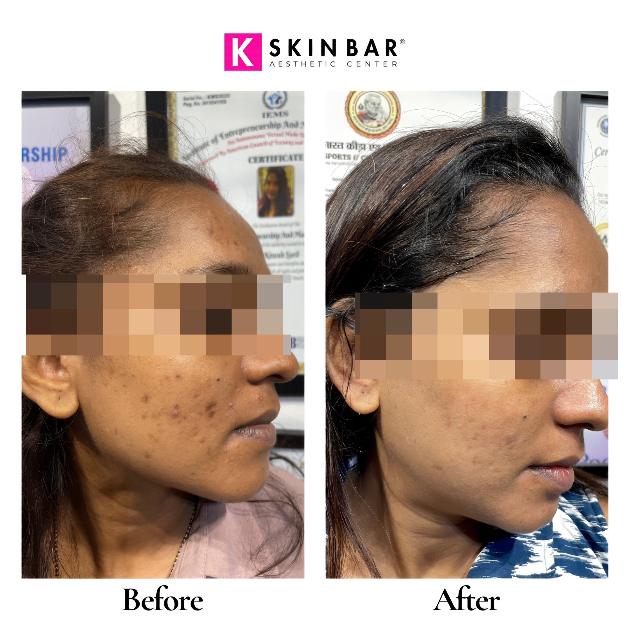 2 KSB SKINCARE HOME KITS
