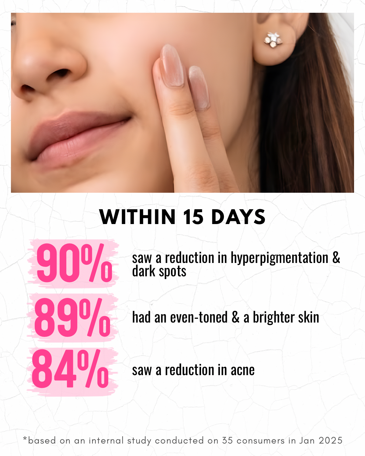 Flawless Skin Serum For Pigmentation